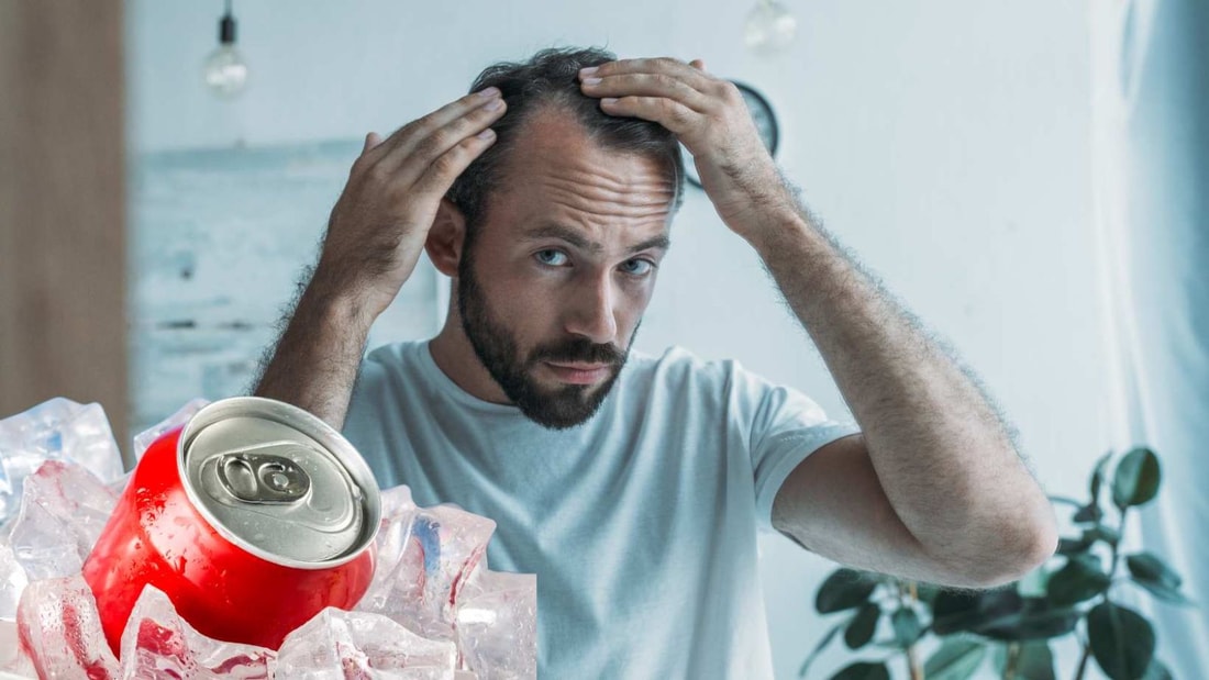 Boissons Sucrées : Le Nouveau Danger pour les Cheveux des Hommes ?