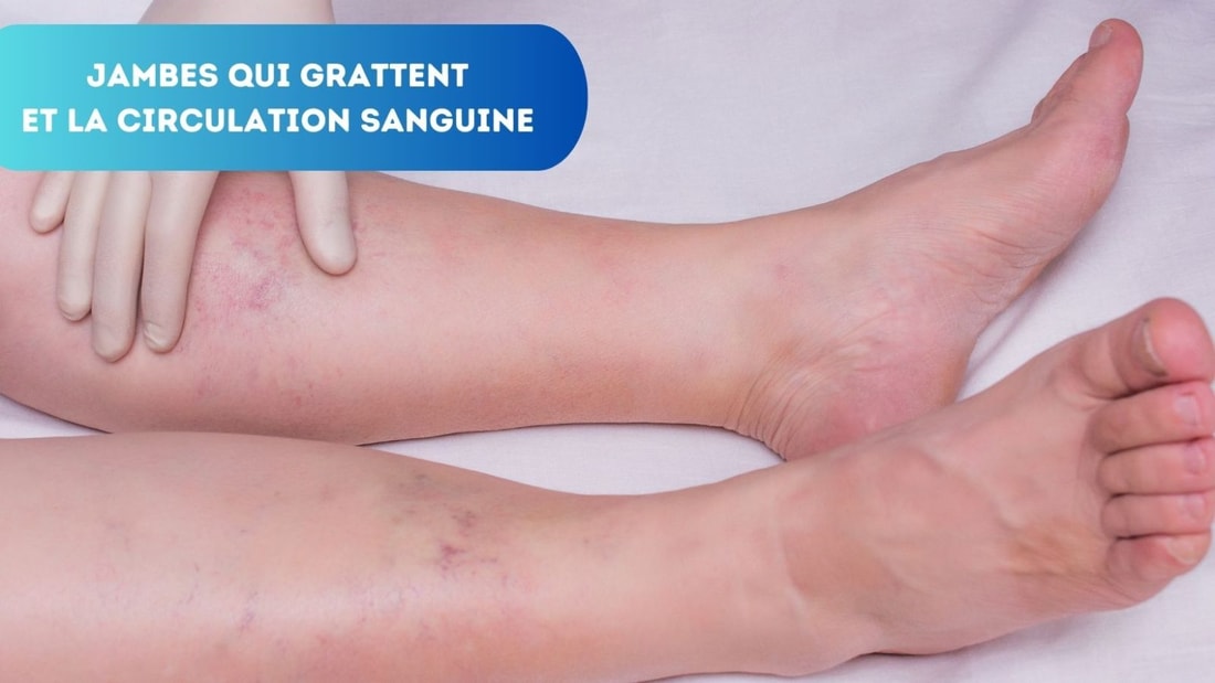 Pourquoi vos jambes grattent-elles ? Liens avec la Circulation Sanguine et Solutions