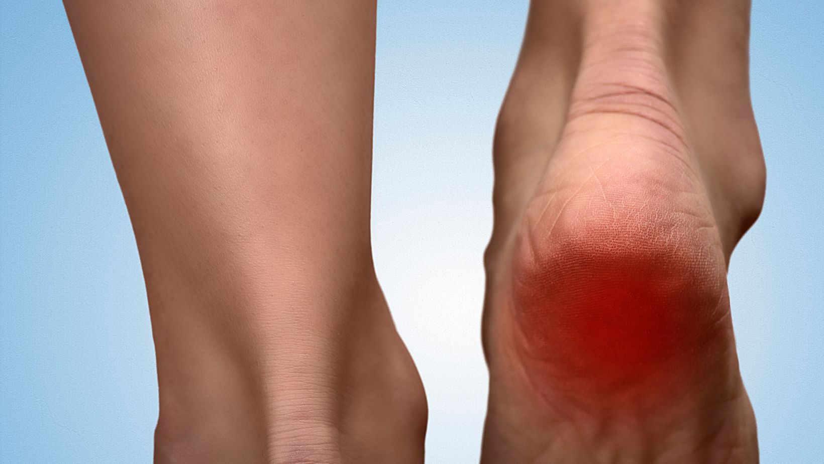 heel pain and cancer relation