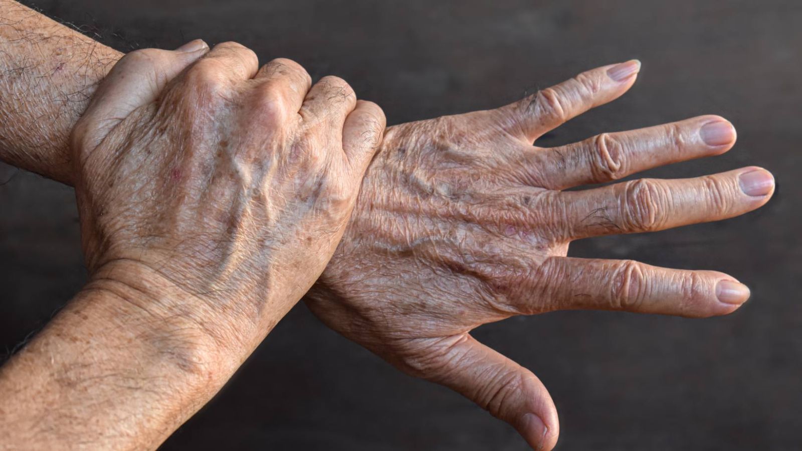 Taches de vieillesse : les meilleurs remèdes de grand-mère pour les estomper naturellement